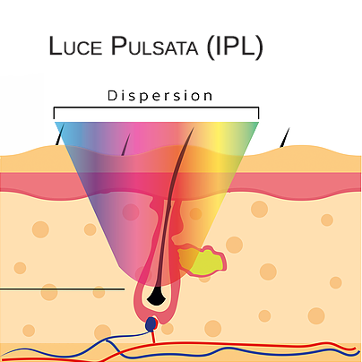 Luce Pulsata funzionamento