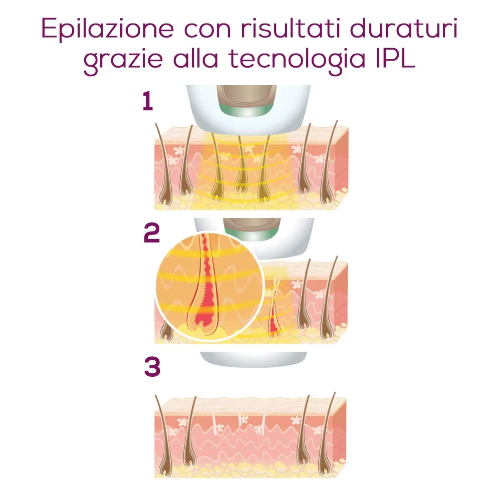 Beurer IPL 5800 PureSkin Pro