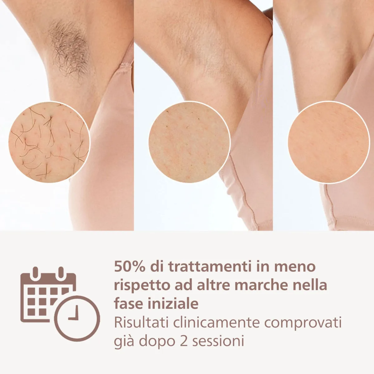 Philips Lumea serie 8000 BRI948
